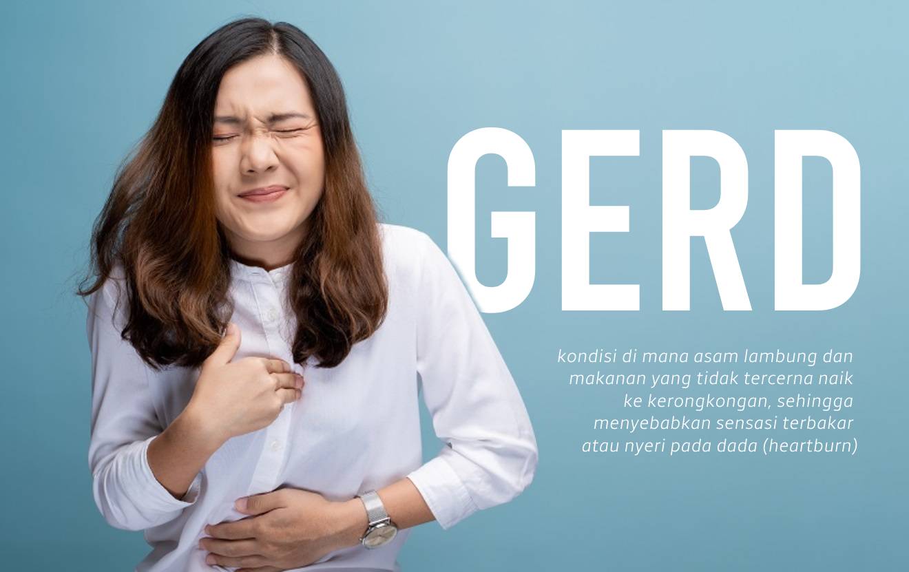 GERD