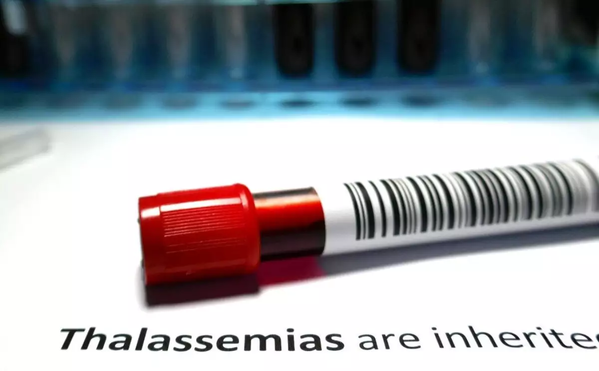 penyakit-thalasemia