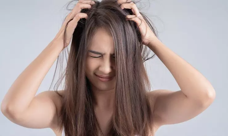 Rahasia Perawatan Rambut Lepek pada Cuaca Panas