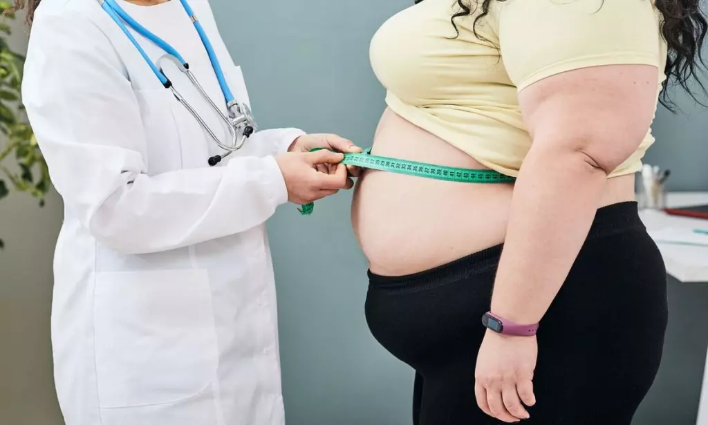Banyak Mendatangkan Risiko Penyakit Serius! Yuk Cegah dan Atasi Obesitas