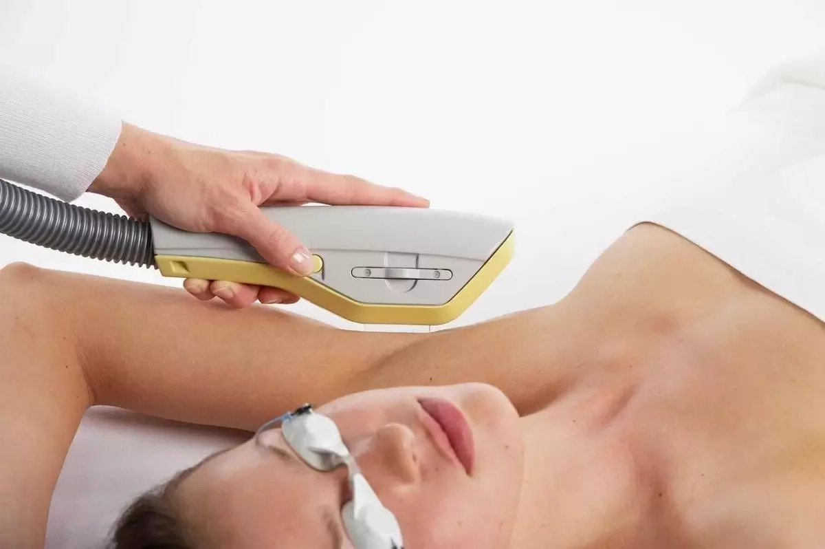 Terapi IPL menjadi cara yang efektif untuk menghilangkan bulu halus ketiak Terapi IPL menjadi cara yang efektif untuk menghilangkan bulu halus ketiak