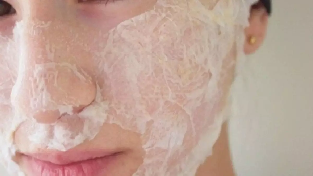 masker putih telur bisa mengencangkan kulit wajah dan menhilangkan jerawat serta komedo masker putih telur bisa mengencangkan kulit wajah dan menhilangkan jerawat serta komedo