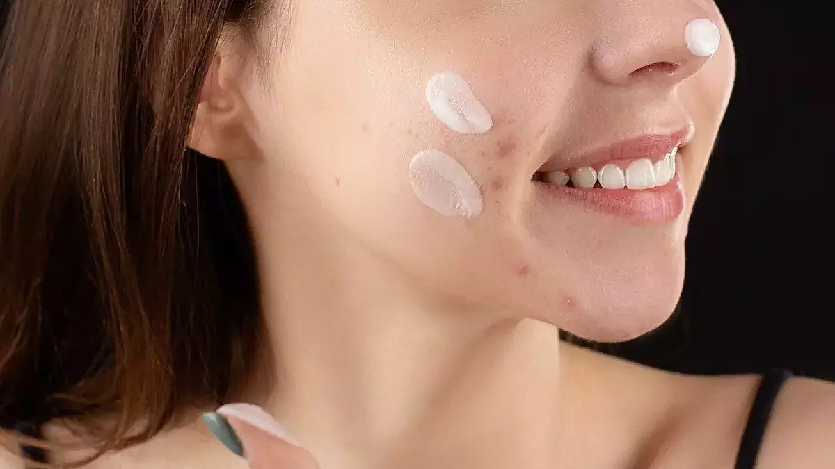 Niacinamide Membantu mengatasi jerawat Niacinamide Membantu mengatasi jerawat