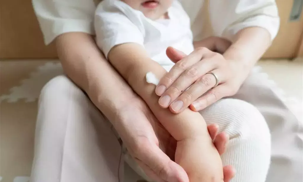 Bolehkah Bayi Menggunakan Sunscreen? Simak Penjelasannya