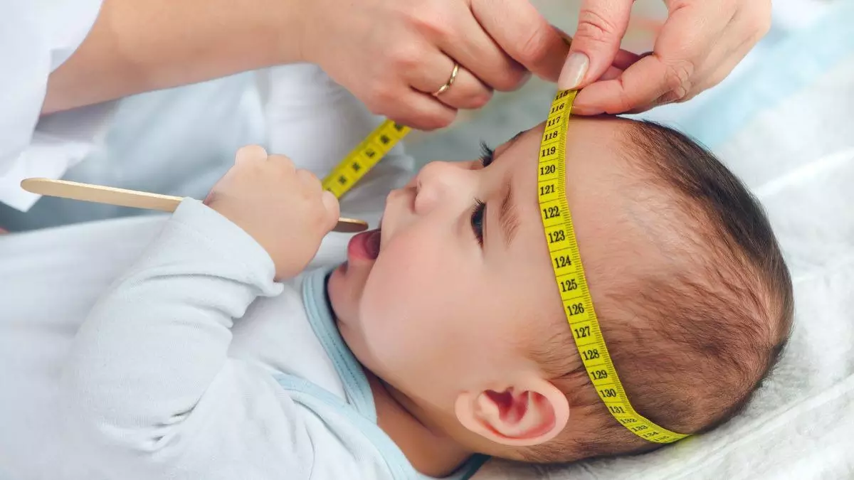 periksakan ke dokter jika kepala bayu terlanjur peyang periksakan ke dokter jika kepala bayu terlanjur peyang