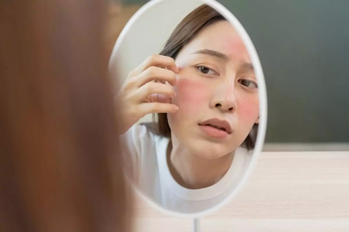 Cara umum mengatasi alergi