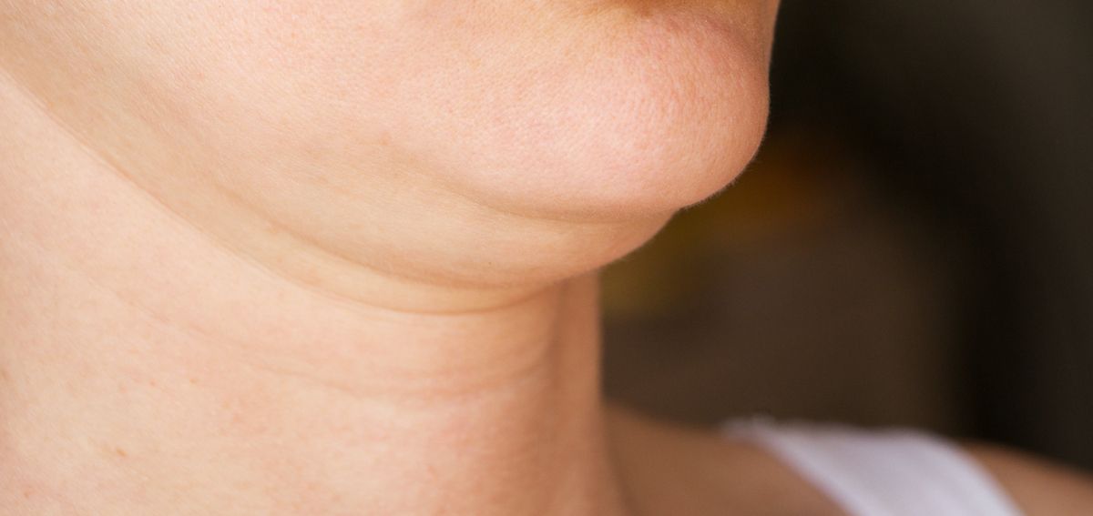 menghilangkan-double-chin