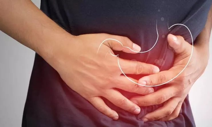9 Cara Meredakan Asam Lambung atau GERD Tanpa Obat