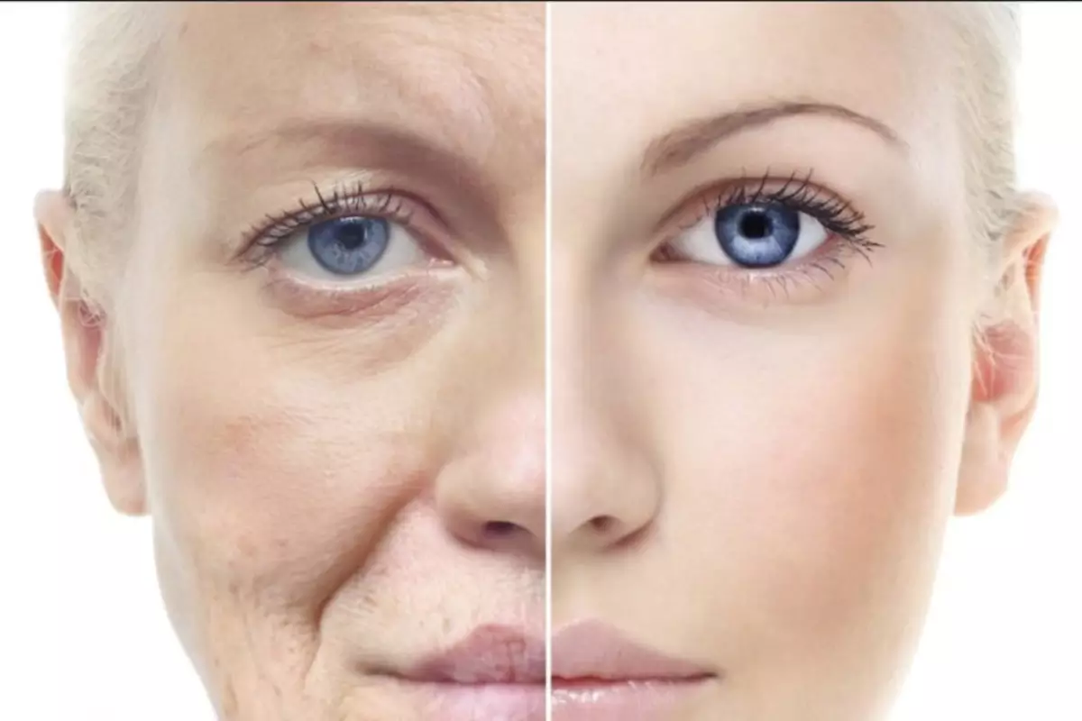 Mencegah Penuaan Dini Mencegah Penuaan Dini