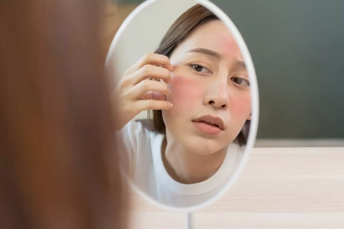 Kulit Sensitif Kulit Sensitif