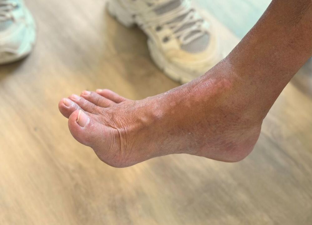 Rajin Mengangkat Kaki