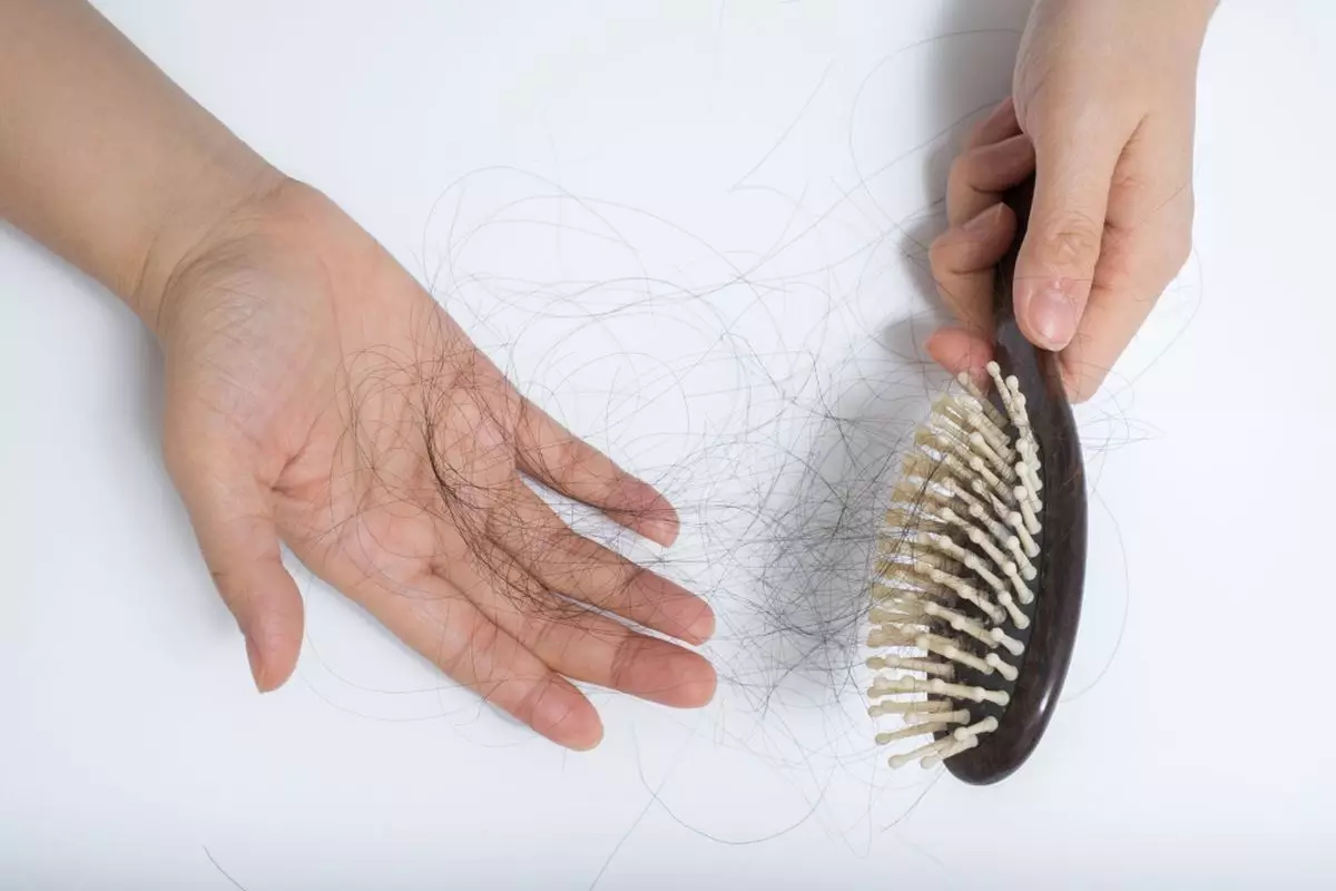 Atasi masalah rambut rontok